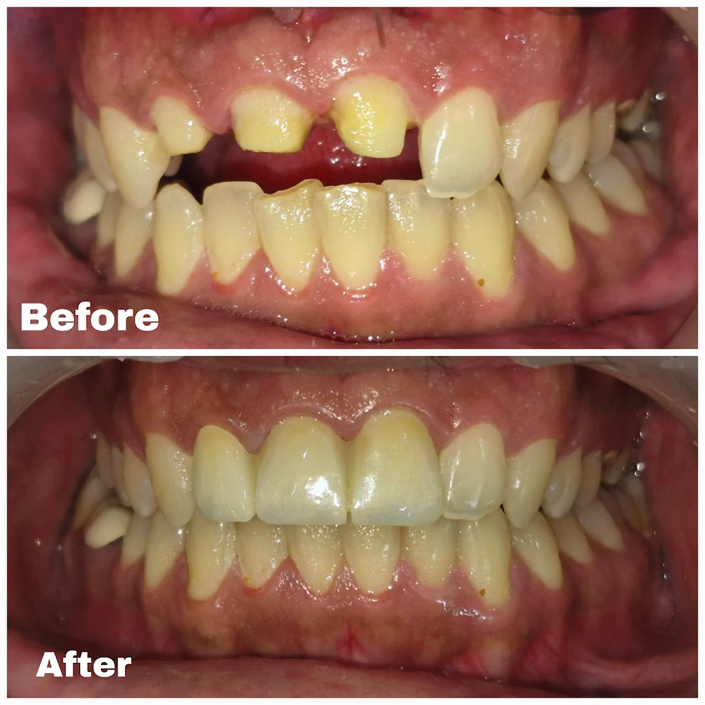 Cleaning & Polishing